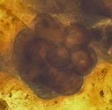 Ch. 9. Pl. 2b CAI2a-neat blastula x 100 compound weighted ps5 montage.jpg